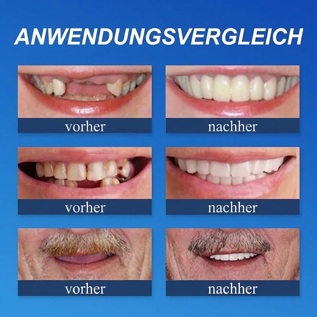 𝐎𝐟𝐟𝐢𝐳𝐢𝐞𝐥𝐥𝐞𝐫 𝐌𝐚𝐫𝐤𝐞𝐧𝐬𝐡𝐨𝐩