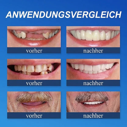 𝐎𝐟𝐟𝐢𝐳𝐢𝐞𝐥𝐥𝐞𝐫 𝐌𝐚𝐫𝐤𝐞𝐧𝐬𝐡𝐨𝐩