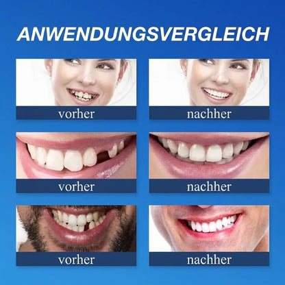 𝐎𝐟𝐟𝐢𝐳𝐢𝐞𝐥𝐥𝐞𝐫 𝐌𝐚𝐫𝐤𝐞𝐧𝐬𝐡𝐨𝐩